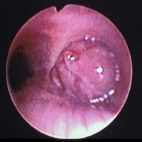 uncommonairway