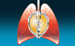 pneumonia