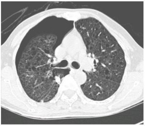 case1-21