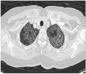 case2-11