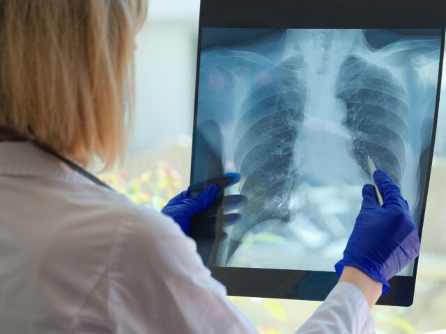 Is It Pneumonia or Bronchitis? How To Tell Them Apart