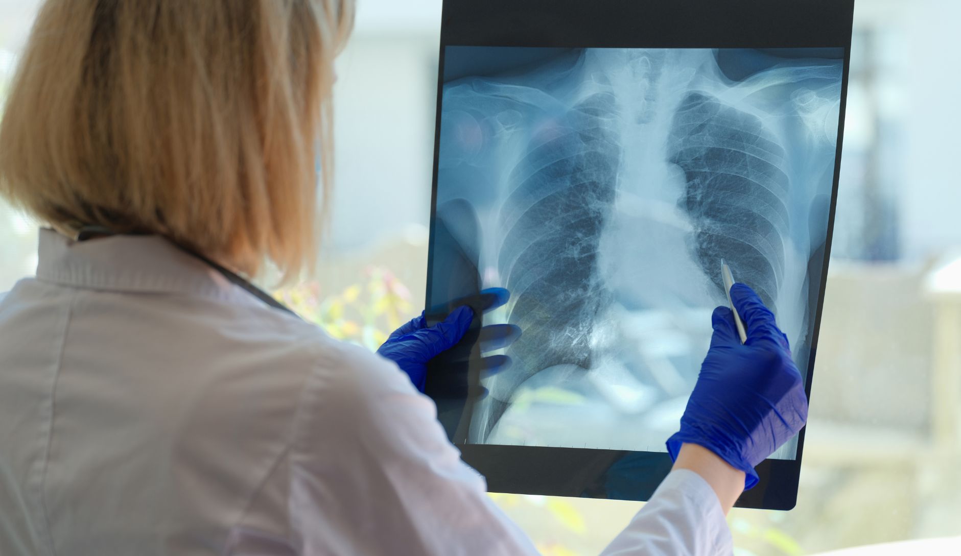 Is It Pneumonia or Bronchitis? How To Tell Them Apart