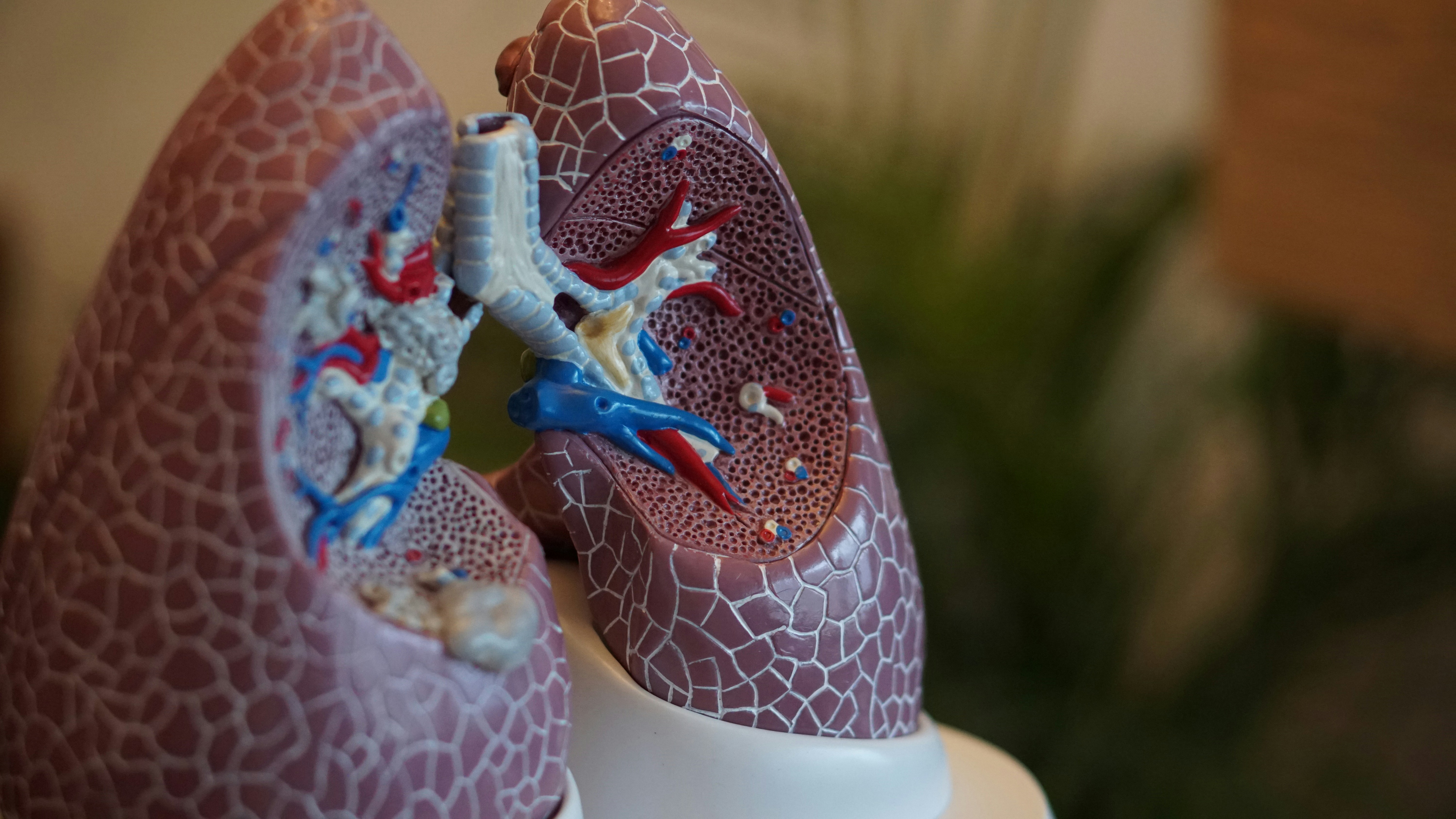Lung Cancer Singapore